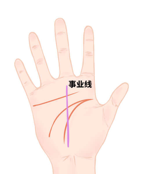 事业线